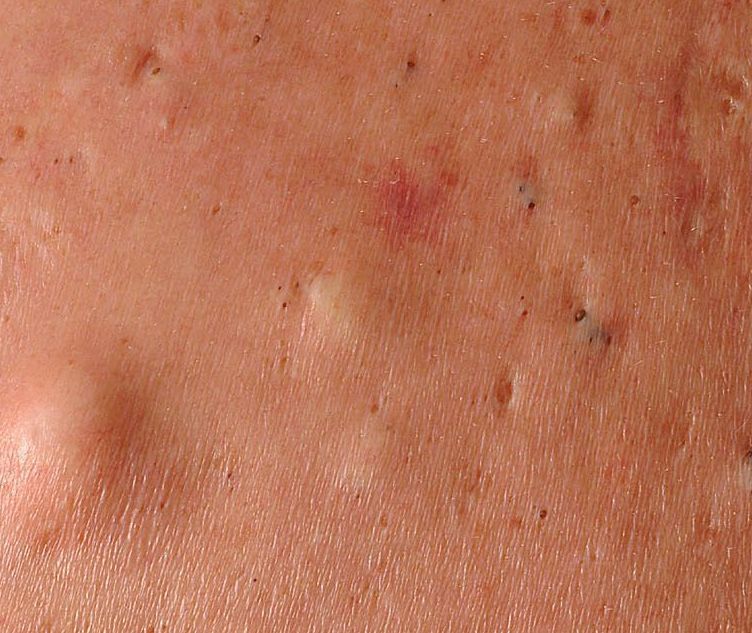 skin